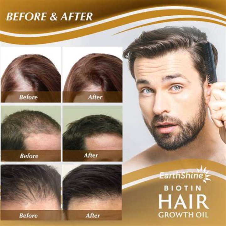 Can biotin regrow hair?