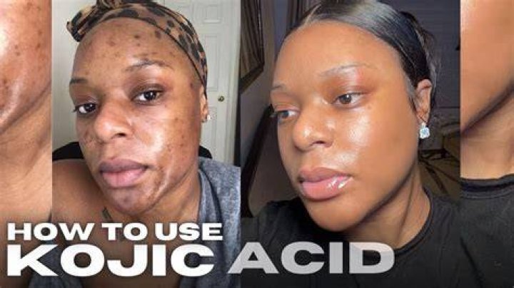 Can I use Kojic soap everyday on face?
