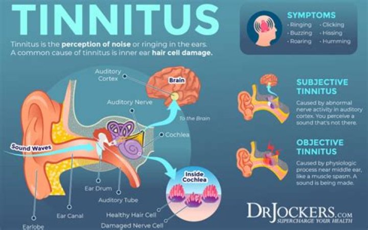 Can tinnitus damage your brain?