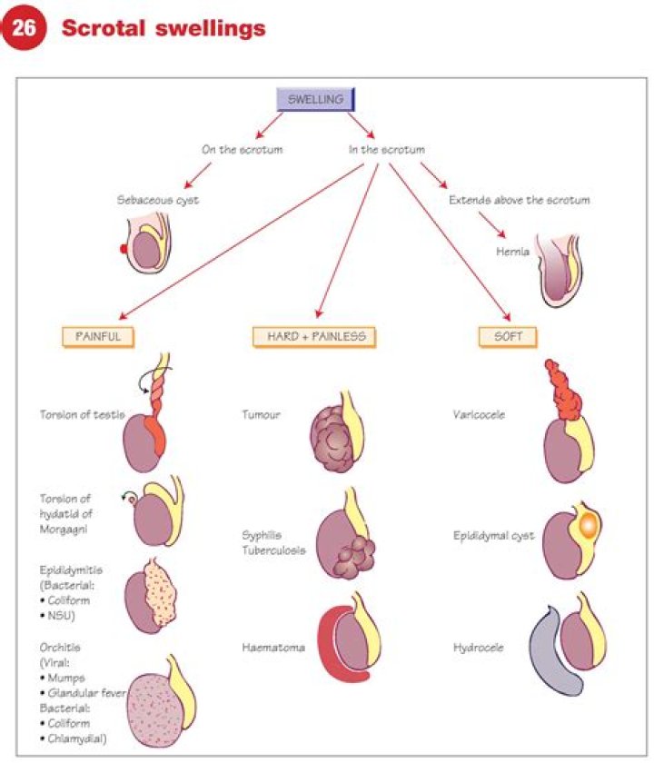 Can UTI cause testicle swelling?