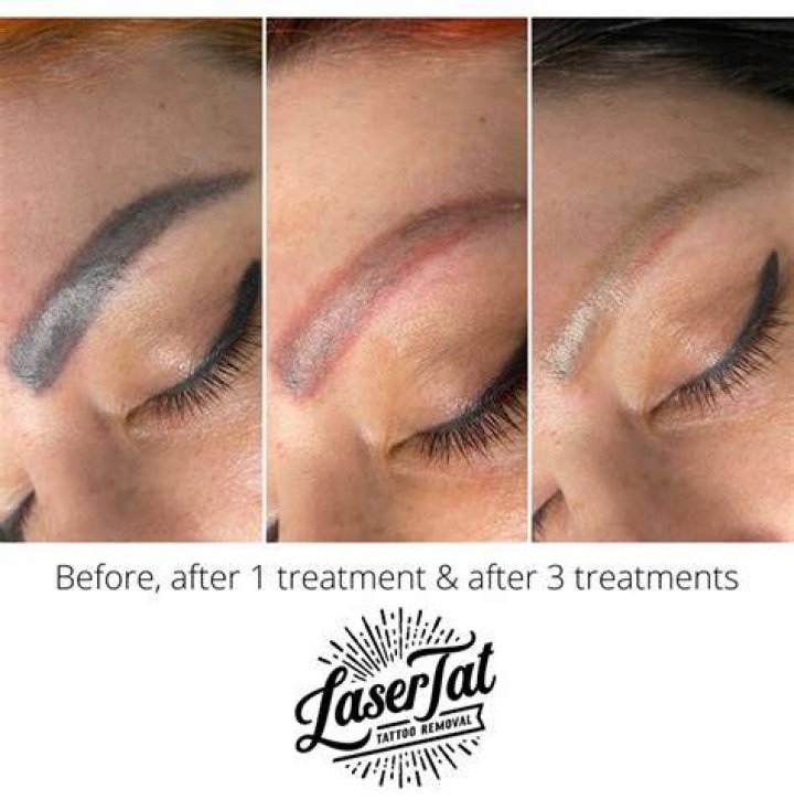 Do you shave your eyebrows before getting them tattooed?