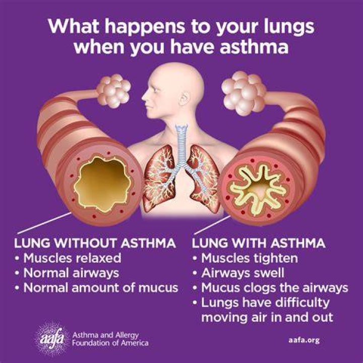Does breathing cold air help asthma?