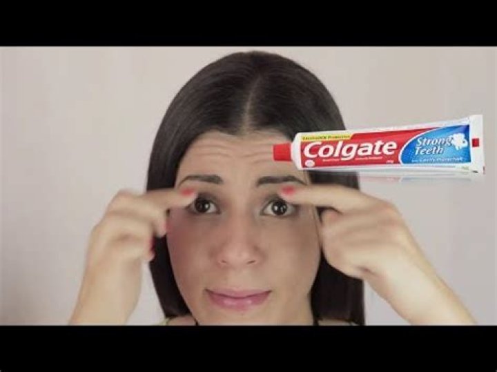 Does toothpaste help dark circles?