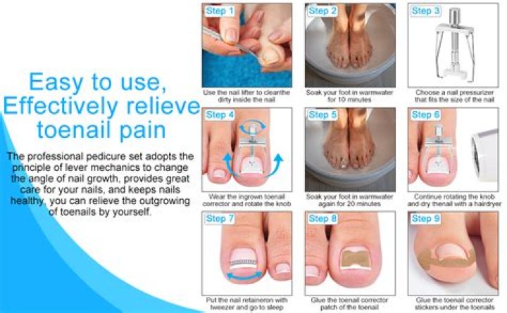 How do you get an ingrown toenail out yourself?