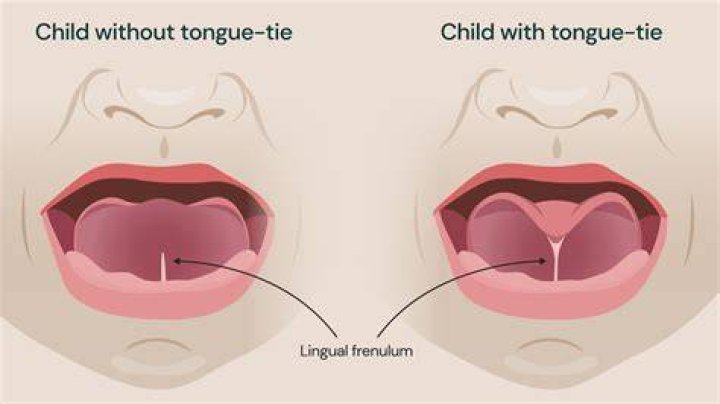 Is it true if you split a crows tongue it can talk?