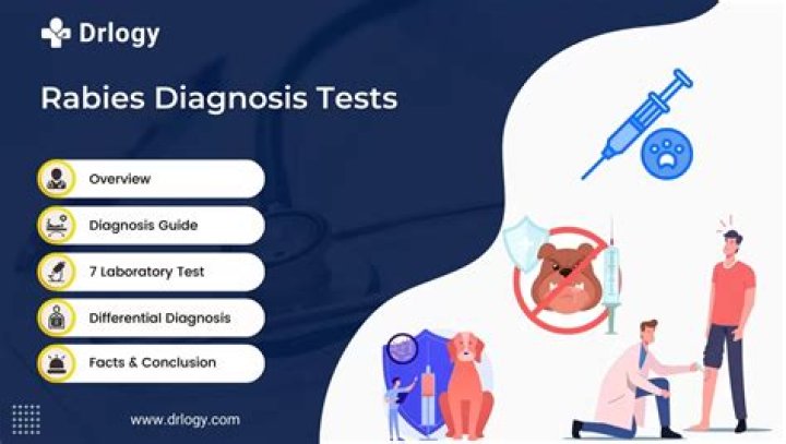 Is there a test for rabies?