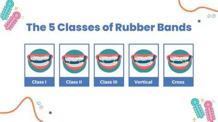 Should I soak rubber bands in oil?