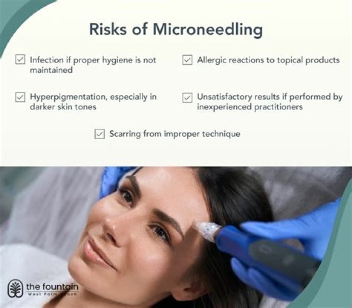 What are the side effects of microneedling?