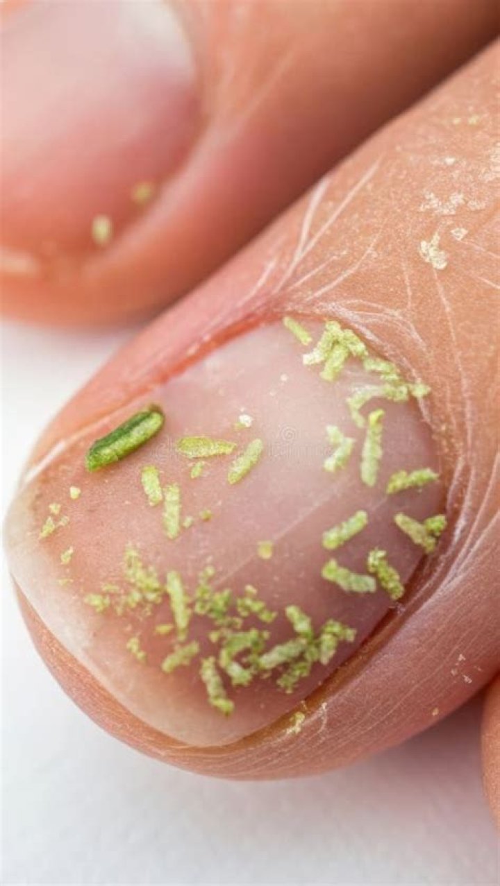 What bacteria is found under fingernails?