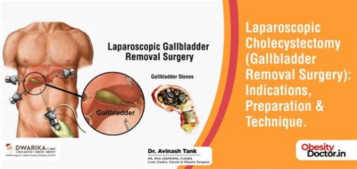 What happens if you wait to get your gallbladder removed?