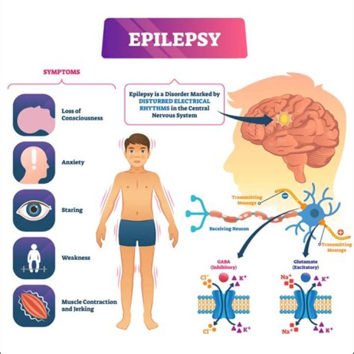 What part of the brain is affected by epilepsy?