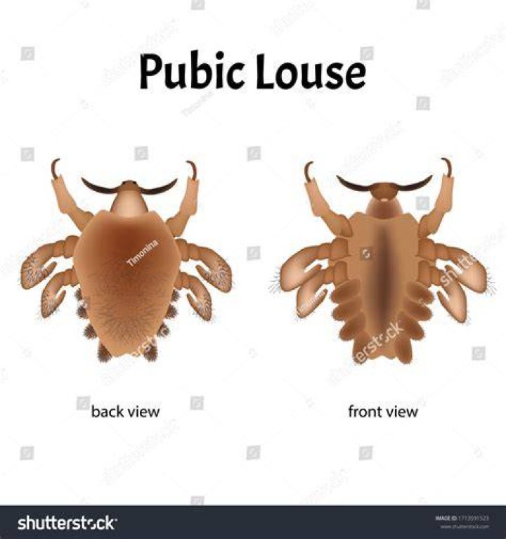 What type of STD is pubic lice?