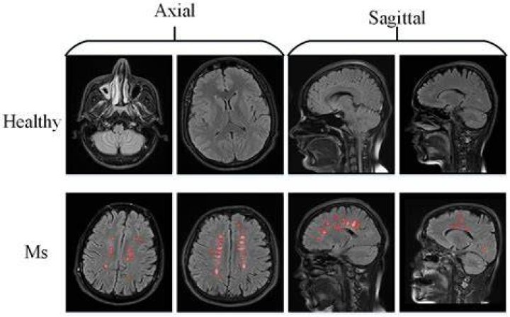 Who reads the results of an MRI scan?