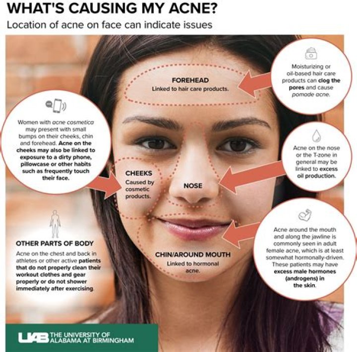 Why is my skin breaking out?