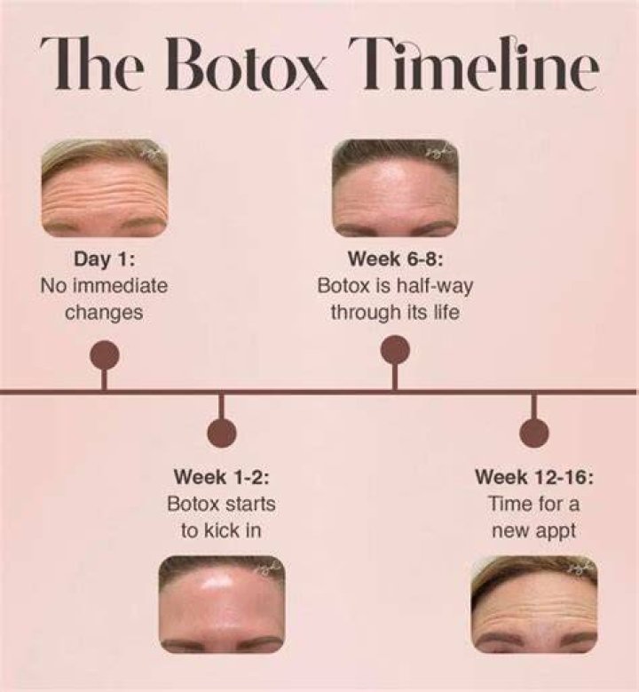 Why you should never do Botox?